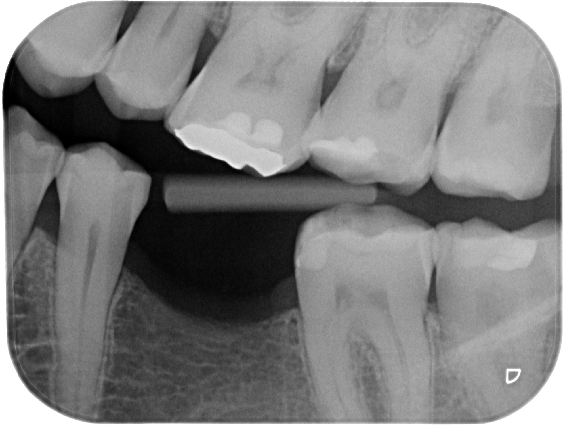 2025-07 Theusner Mende 2
